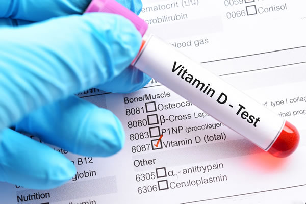 ویتامین D در آزمایشات